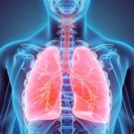 Cancer du poumon : une alimentation trop saine augmente les risques ?